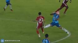 Enlace a En Bolivia un jugador sufrió fractura de tibia y peroné después de una salvaje entrada.