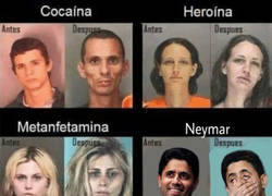 Enlace a Antes y después