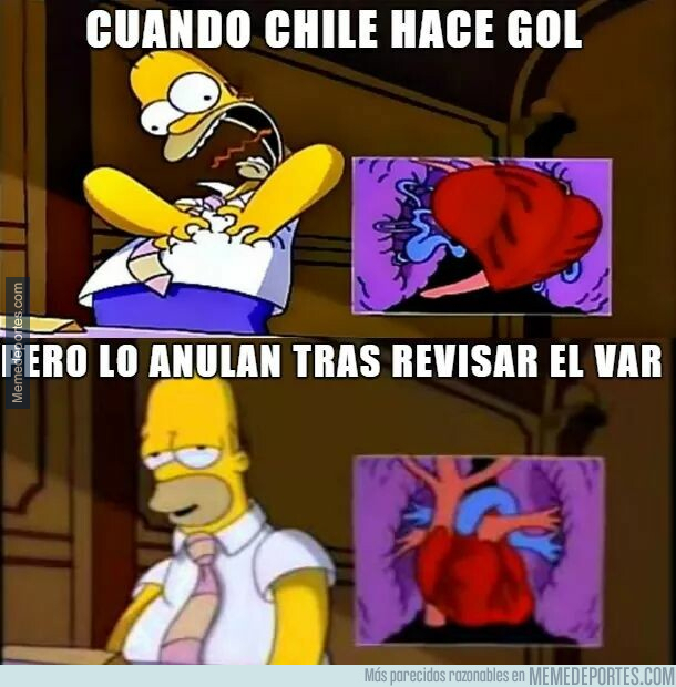 1079539 - Mientras tanto en Colombia