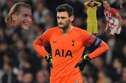 Enlace a Lloris con los pies da pena