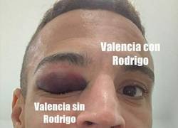 Enlace a Diferencias en Rodrigo