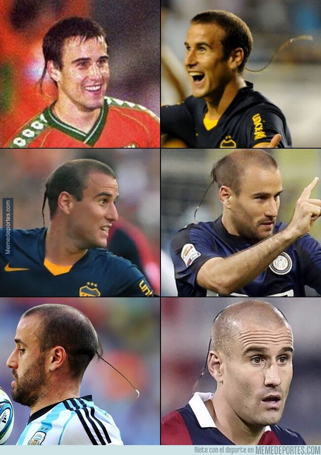 1092001 - La trenza de Palacio que venció incluso el progreso de la alopecia.