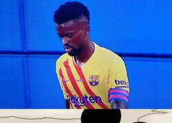 Enlace a Portadores de brazalete que dañan la vista