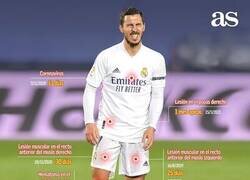Enlace a Todas las lesiones de Hazard con el Madrid. No da basto.