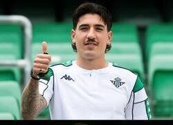 Enlace a ¿Que le ha pasado a Hector Bellerín?