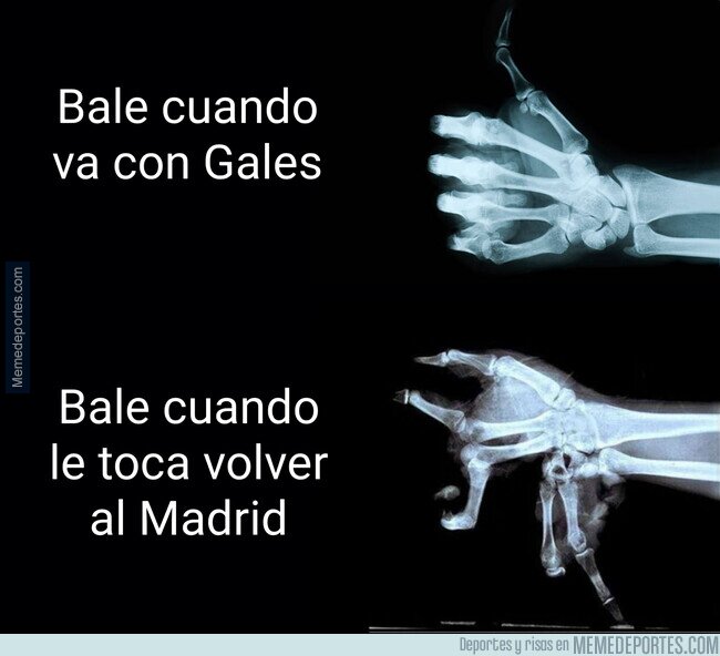 1149013 - La mano de Gareth