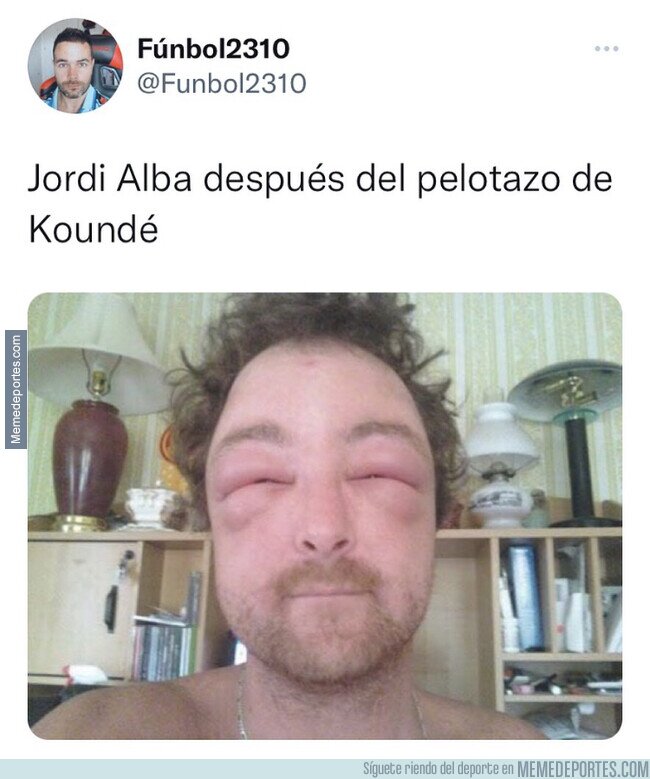 1151612 - Menudo pelotazo se llevó