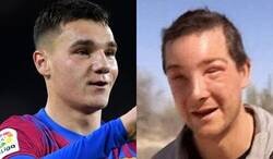 Enlace a Ferrán tiene cara de que le ha picado una abeja