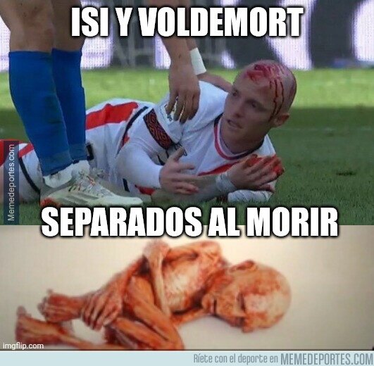 1152780 - Por algo Harry llevaba un Rayo