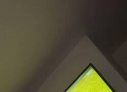 Enlace a El impresionante chichón de Brice Samba, el portero del Nottingham