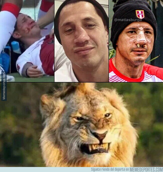 1154184 - La naríz de Lapadula tras el partido contra Colombia