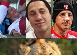 Enlace a La naríz de Lapadula tras el partido contra Colombia