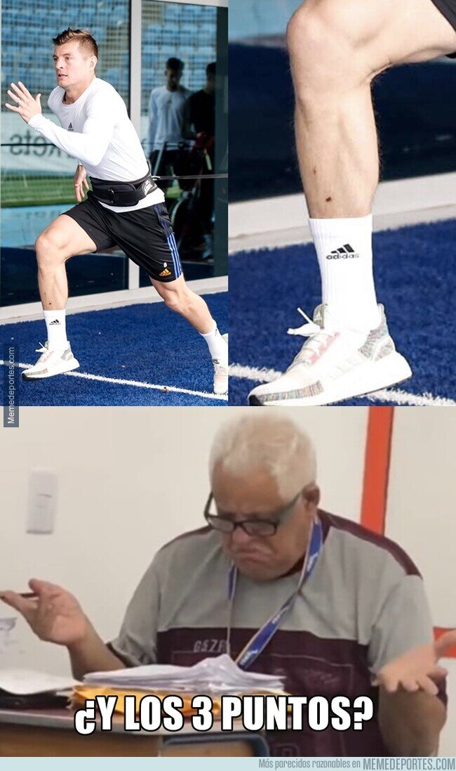 1157816 - He visto granos de Asensio más graves que esto