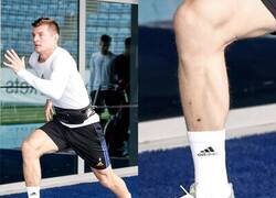 Enlace a He visto granos de Asensio más graves que esto