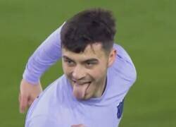 Enlace a ¿Qué le pasa al brazo de Pedri?