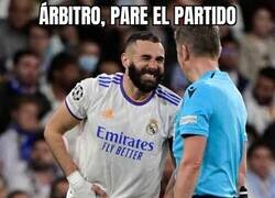 Enlace a Benzema tuvo un problema en sus partes