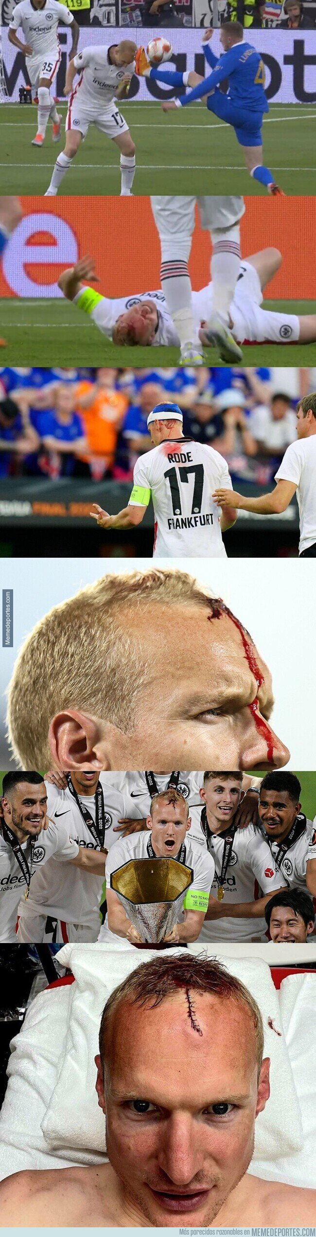 1161827 - Sebastian Rode completó todo el partido con una grieta en la cabeza y levantó el trofeo de campeones.