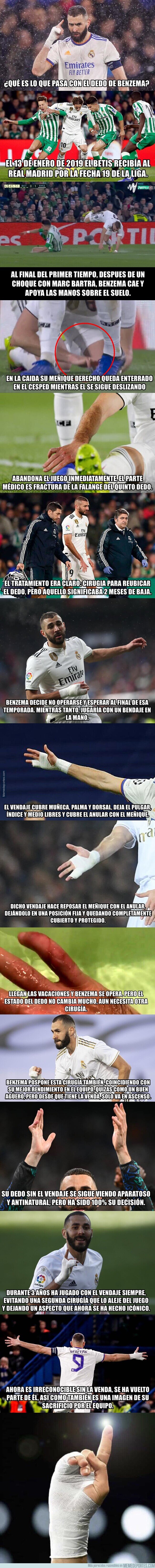 1162359 - La venda de Benzema