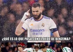 Enlace a La venda de Benzema