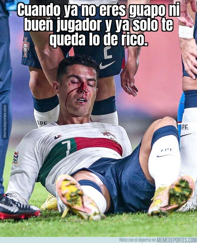 1170723 - A Cristiano le han partido la nariz