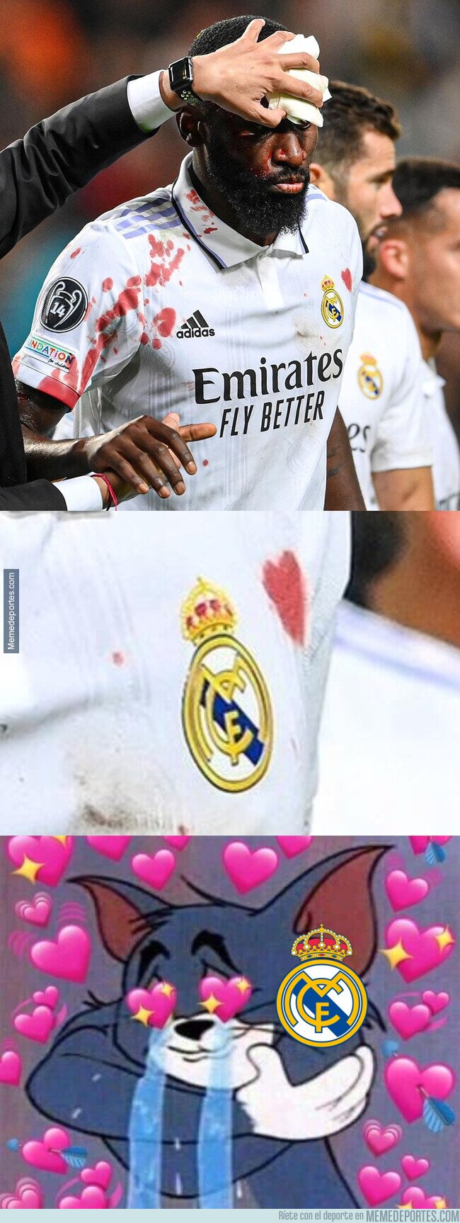 1171738 - La sangre de Rudiger formó un corazón junto al escudo del Real Madrid