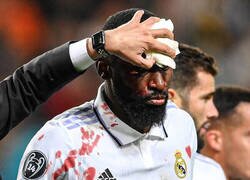 Enlace a La sangre de Rudiger formó un corazón junto al escudo del Real Madrid