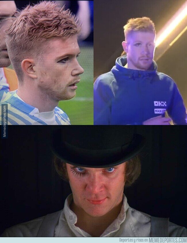1172720 - El moretón de De Bruyne le ha dejado un delineado perfecto
