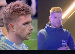 Enlace a El moretón de De Bruyne le ha dejado un delineado perfecto