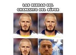 Enlace a Las ruedas del carrito