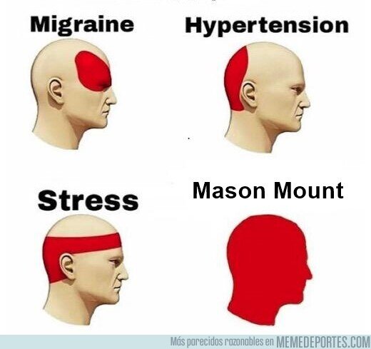 1178734 - Tenía mucho tiempo sin ver a un jugador tan limitado con el balón