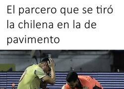 Enlace a Todo sea por la acrobacia