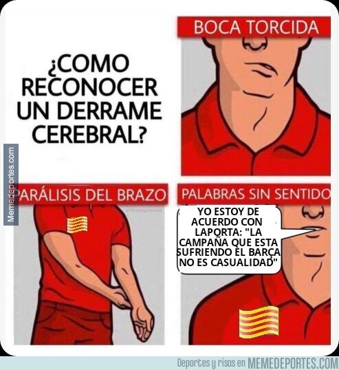 1183959 - Cómo detectar un ictus