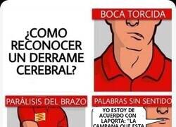 Enlace a Cómo detectar un ictus