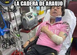 Enlace a La cadera ya no esta en su sitio...