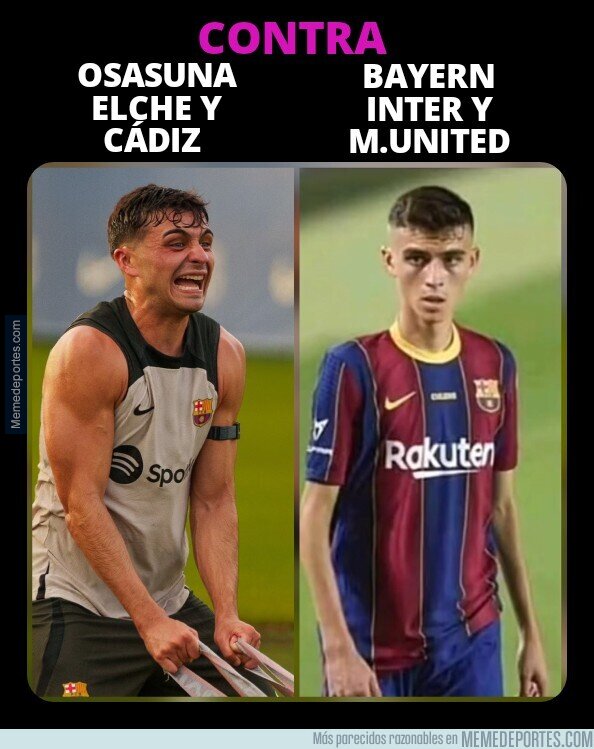 1192170 - Las dos caras de Pedri