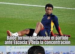 Enlace a Una lesión más para el Barça