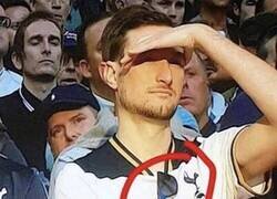 Enlace a Fan del Tottenham, se entiende perfecto