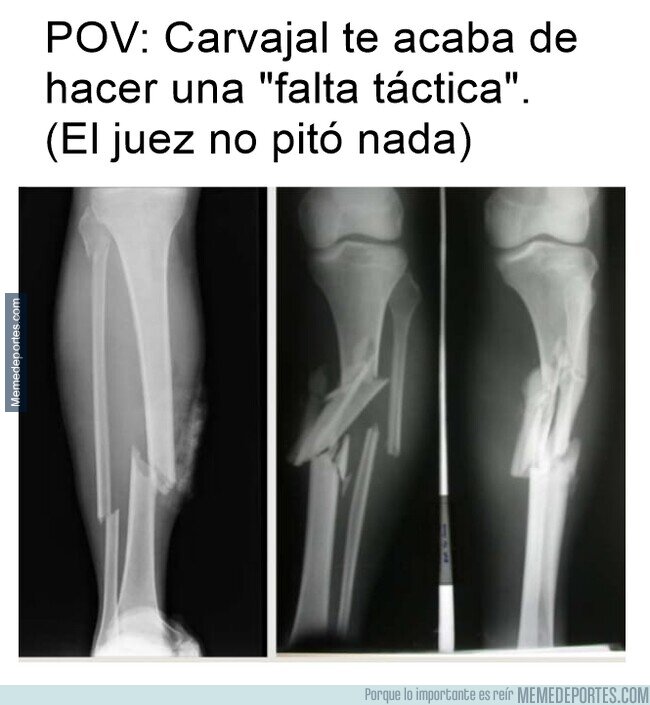 1201647 - Carvajal tiene cositas de Casemiro