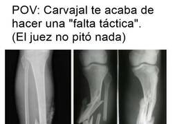 Enlace a Carvajal tiene cositas de Casemiro