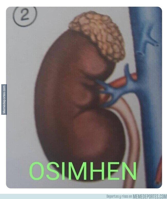 1201919 - Pero si es igualito