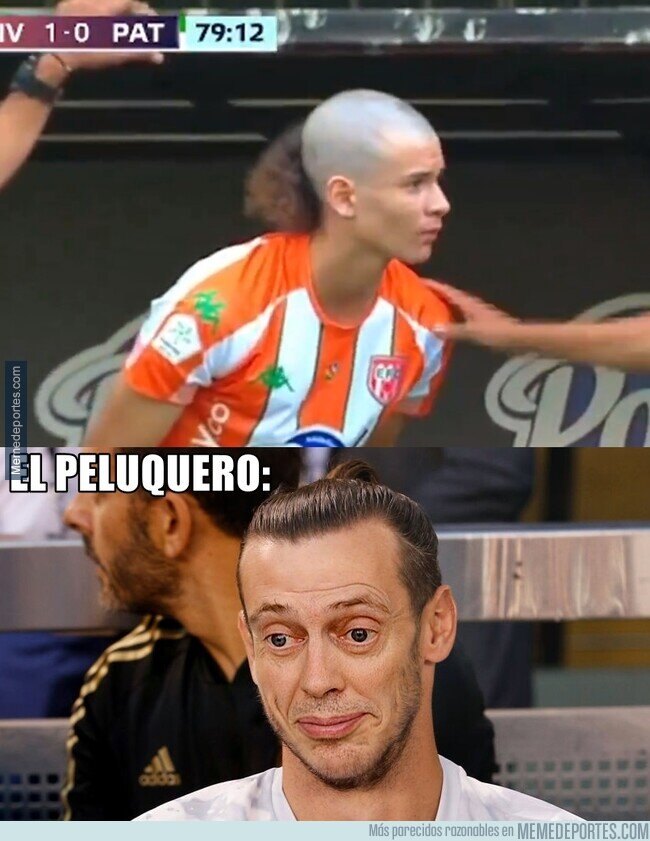 1202041 - El corte de pelo más feo que he visto