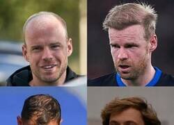 Enlace a Amigos de implante