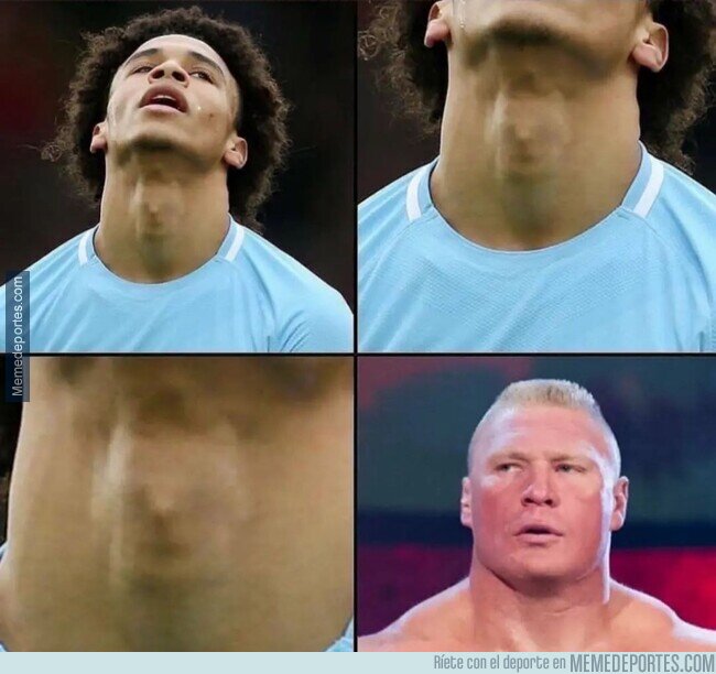 1203211 - Me encontré con Brock Lesnar en la nuez de Leroy Sané