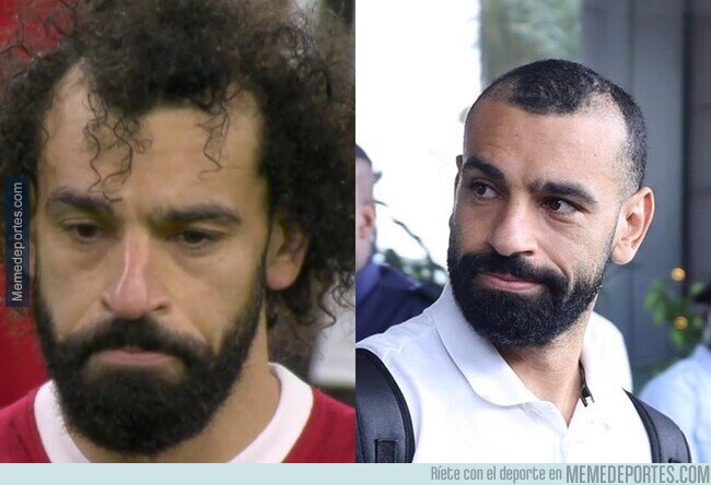 1206024 - Confirmado que lo de Salah es un tratamiento de implante capilar