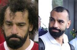 Enlace a Confirmado que lo de Salah es un tratamiento de implante capilar
