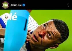 Enlace a Ya está acostumbrado 