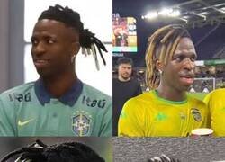 Enlace a Vinicius y los dreads. ¿Cómo le luce mejor?