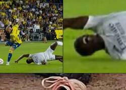 Enlace a Esta cara de Mendy...