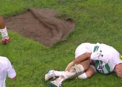 Enlace a Falta del césped