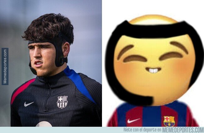 1212042 - ¿Cómo son tan rápidos?